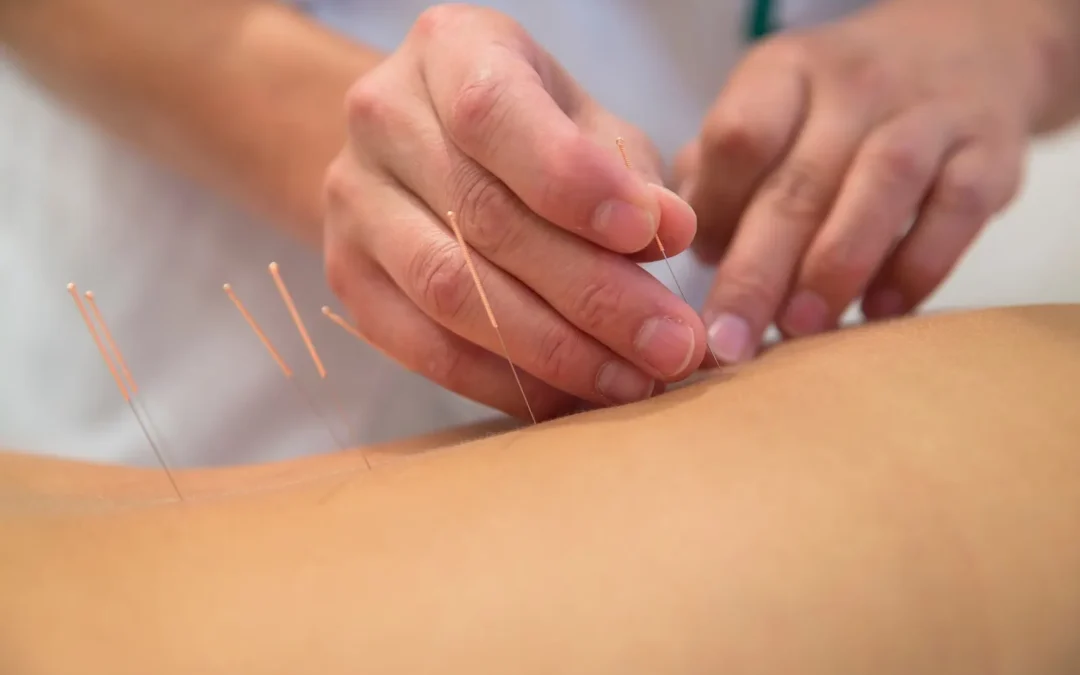 Discover the Benefits of Orthopedic and Sports Medicine Acupuncture